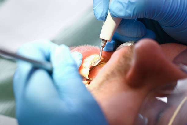 Best Broken or Cracked Tooth Emergency Dentist in Moraine, OH