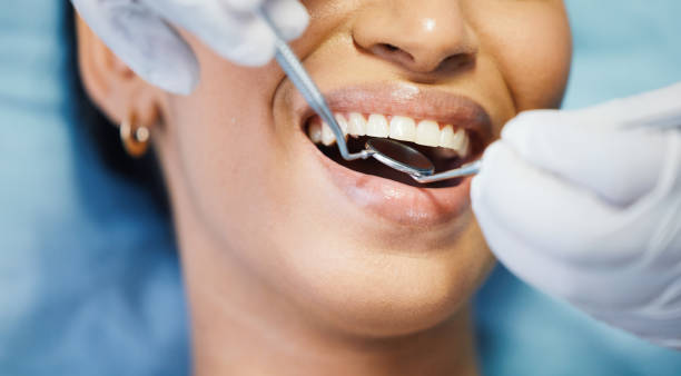Best Emergency Dental Care for Abscessed Tooth in Moraine, OH